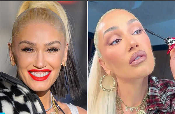 gwen stefani plastic surgery