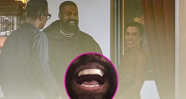 Kanye West se puso dientes de titanio