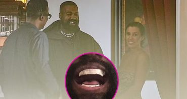 Kanye West se puso dientes de titanio