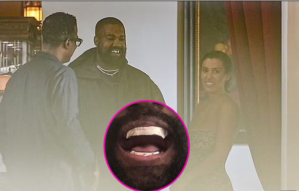 Kanye West se puso dientes de titanio