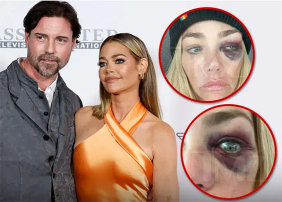 Denise Richards acusa a su ex Aaron Phypers de violencia doméstica