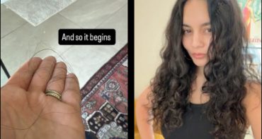 Vanessa Hudgens perdiendo el cabello